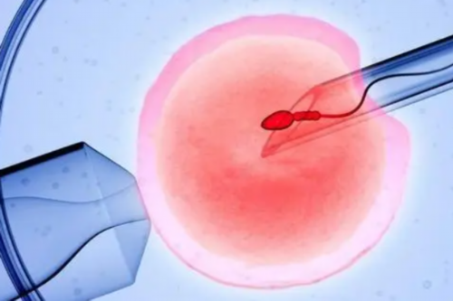 美国助孕费用要多少？不是每个州都允许助孕