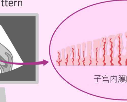 沈阳第三代试管婴儿成功率高低和什么有关？