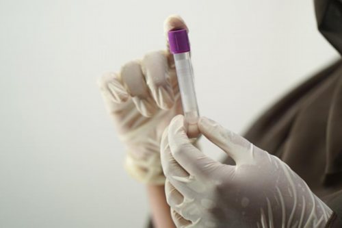 用别人的卵子做试管合法吗?