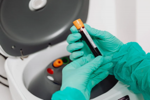 做B超差点被尿憋死