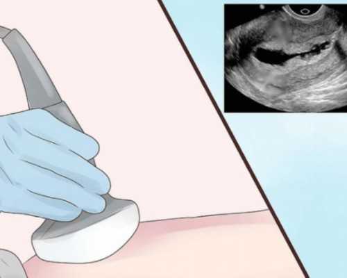 人工助孕生男孩的几率大吗