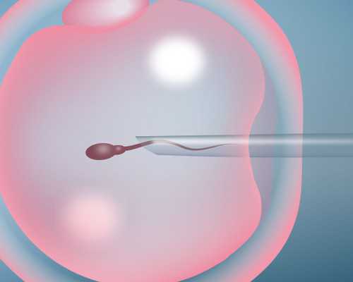 高龄女性助孕都有什么方式，以及助孕的注意事项