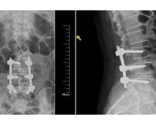 孕晚期去胎毒的偏方真不靠谱！这3大饮食疗法更科学
